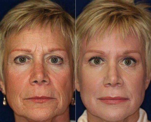 Ageloc Galvanic Spa - Afbeelding 5