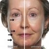 Ageloc Galvanic Spa met Facial Gels - Afbeelding 6